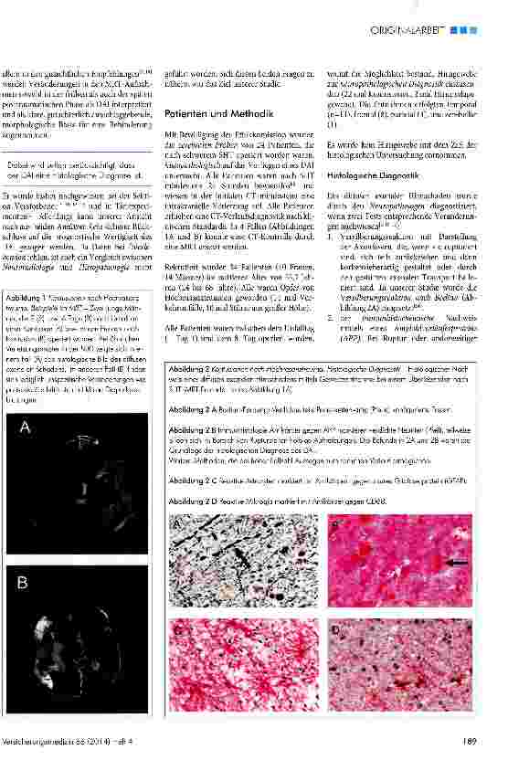 Vorschauseite 2: Der histologische Nachweis des diffusen axonalen Hirnschadens bei Überlebenden schwerer Schädel Hirntraumen