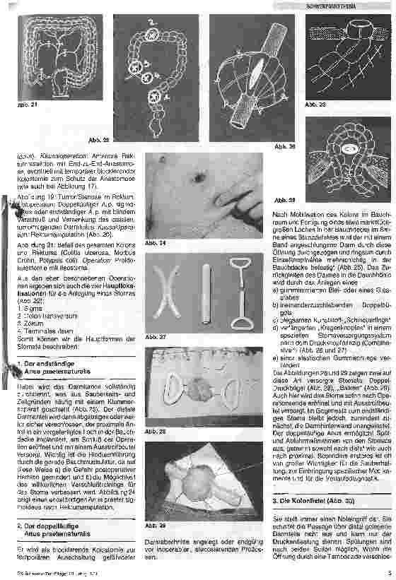 Vorschauseite 4: Stomaversorgung/Das Stoma/Indikationen, Methoden, Arten