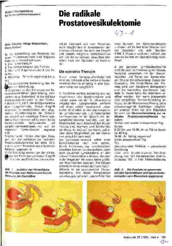 Vorschauseite 1: Die radikale Prostataveskulotomie