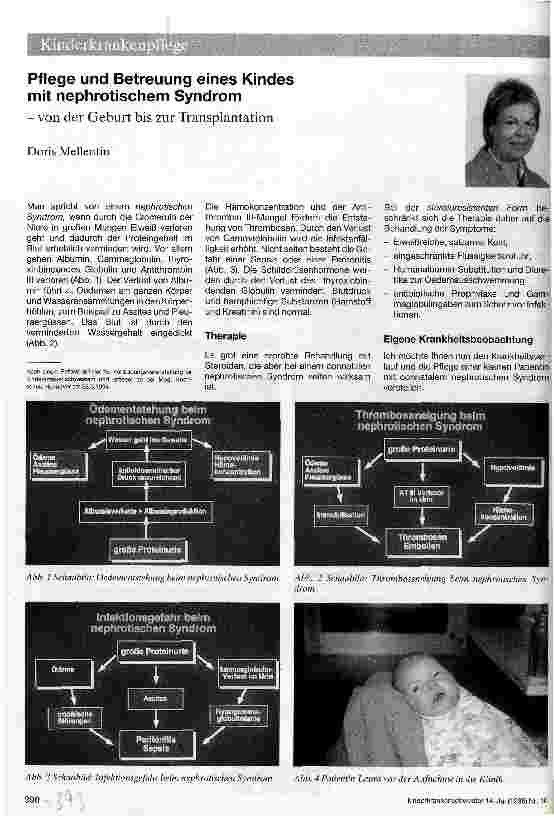 Vorschauseite 1: Pflege und Betreuung eines Kindes mit nephrotischem Syndrom Von der Geburt bis zur Transplantation