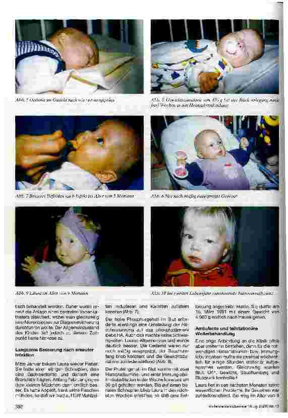 Vorschauseite 3: Pflege und Betreuung eines Kindes mit nephrotischem Syndrom Von der Geburt bis zur Transplantation