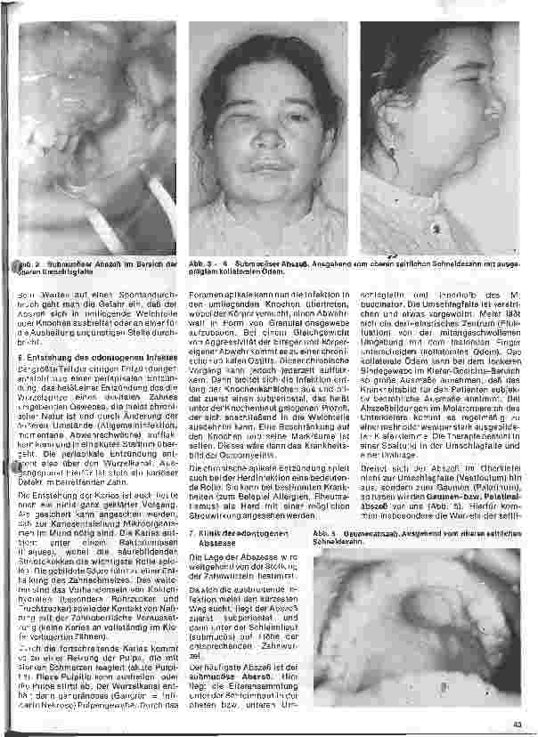 Vorschauseite 4: Zahn-, Mund-und Kieferchirurgie 4. Folge: Unspezifische Entzündungen im Bereich der Mundhöhle