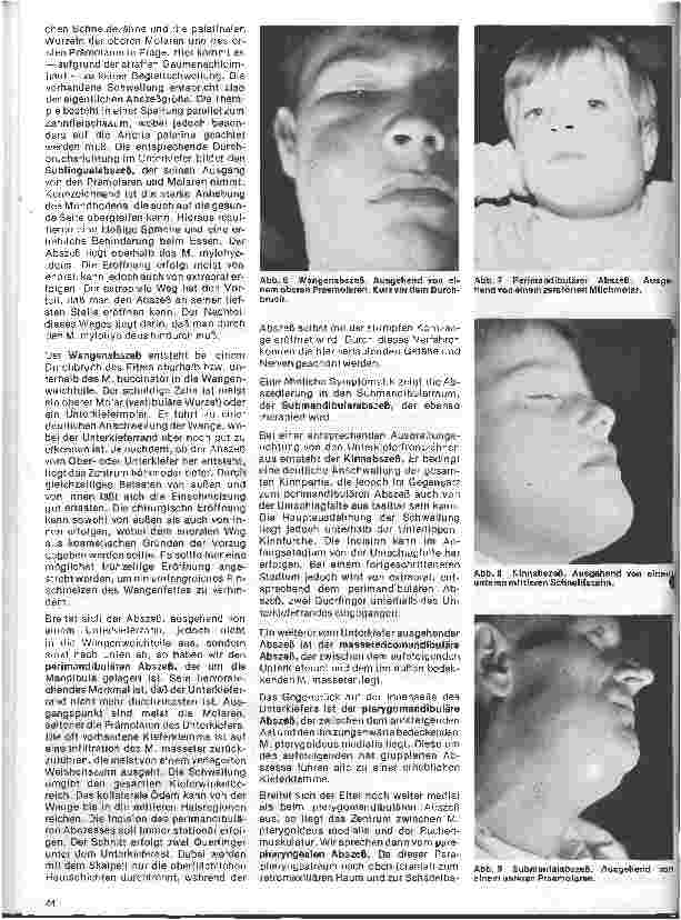 Vorschauseite 5: Zahn-, Mund-und Kieferchirurgie 4. Folge: Unspezifische Entzündungen im Bereich der Mundhöhle