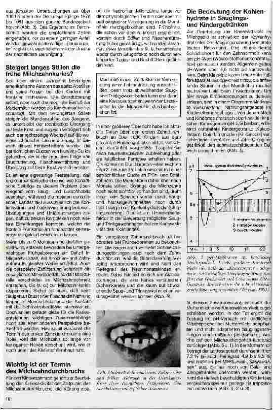Vorschauseite 2: Führen frühe Saugund Trinkgewohnheiten zu Karies im Milchgebiß?