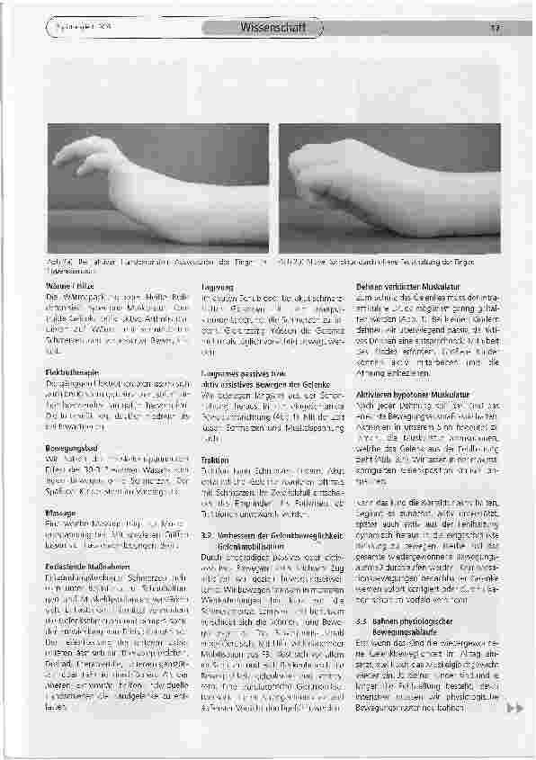 Vorschauseite 3: Physiotherapie im Deutschen Zentrum für Kinderund Jugendrheumatologie in Garmisch-Partenkirchen
