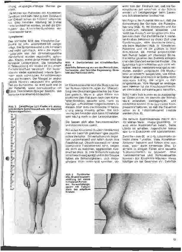 Vorschauseite 2: Kinderheilkunde - Vererbte Krankheiten 3. Folge: Das Klinefelter-Syndrom