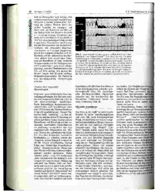 Vorschauseite 4: Mechanische Pumpen als Ersatz der Herzfunktion- Kunstherzen und Kunstventrikel