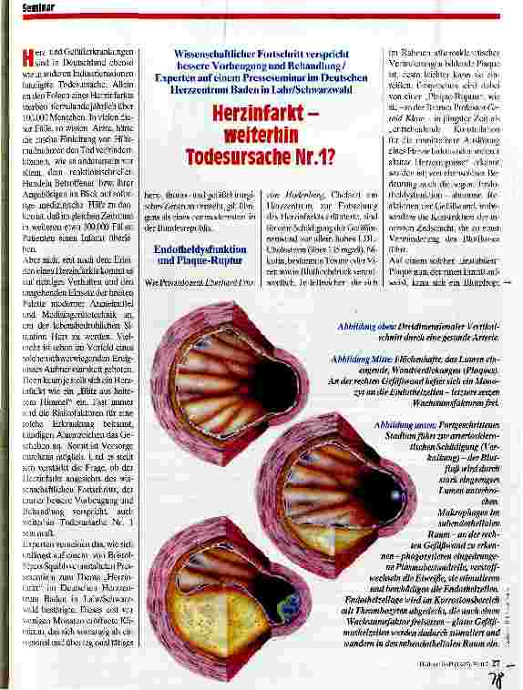 Vorschauseite 1: Herzinfarkt - weiterhin Todesursache Nr. 1? Wissenschaftlicher Fortschritt verspricht bessere Vorbeugung und Behandlung/Experten auf einem Presseseminar im Deutschen Herzzentrum B…
