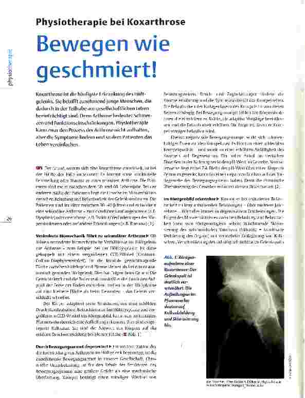 Vorschauseite 1: Physiotherapie bei Koxarthrose Bewegen wie geschmiert!