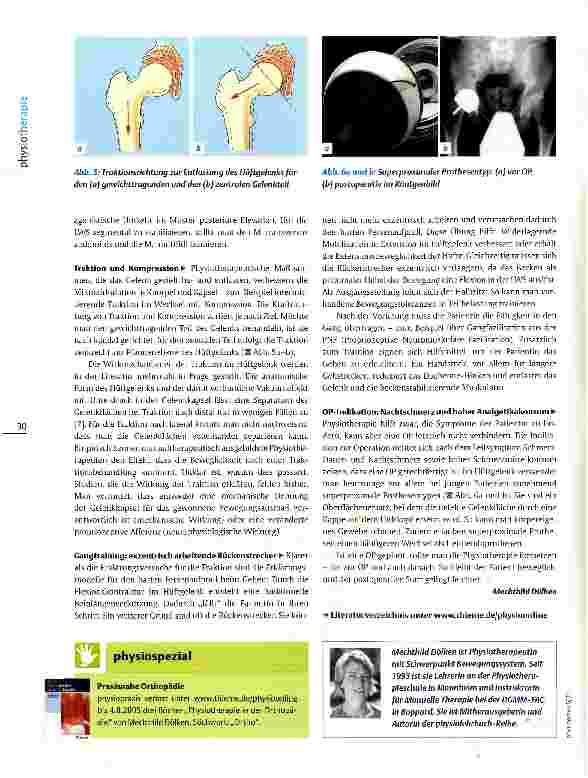 Vorschauseite 5: Physiotherapie bei Koxarthrose Bewegen wie geschmiert!