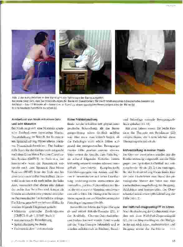 Vorschauseite 2: Physiotherapie bei Infantiler Zerebralparese