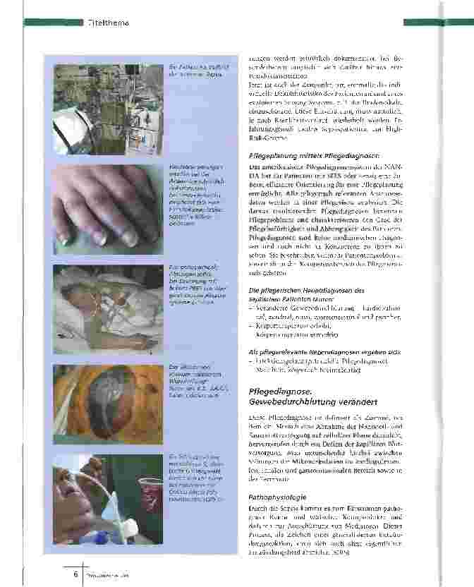 Vorschauseite 3: SIRS und SepsisKomplikation mit High Risk