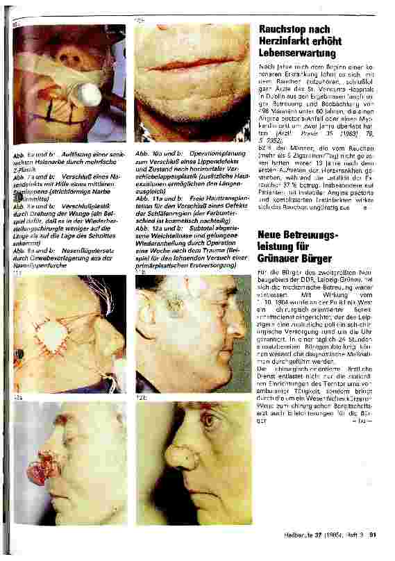 Vorschauseite 4: Moderne Möglichkeiten der plastischen Gesichtschirurgie
