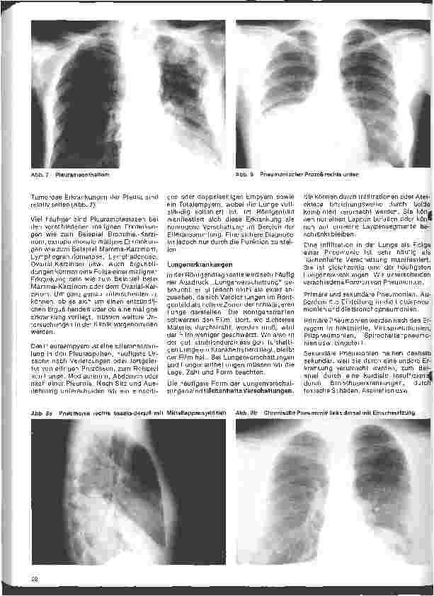 Vorschauseite 3: Radiologie 26. Folge: Röntgenuntersuchung der Thoraxorgane (1)