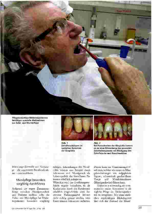 Vorschauseite 2: ORALEN KOMPLIKATIONEN VORBEUGEN