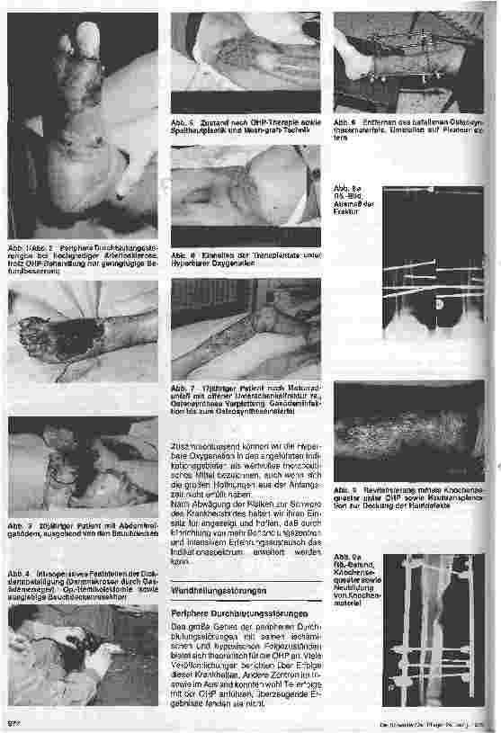 Vorschauseite 2: Die hyperbare Medizin - Möglichkeiten und Grenzen der Sauerstoff-Überdrucktherapie (7. Folge) Relative Intikationen