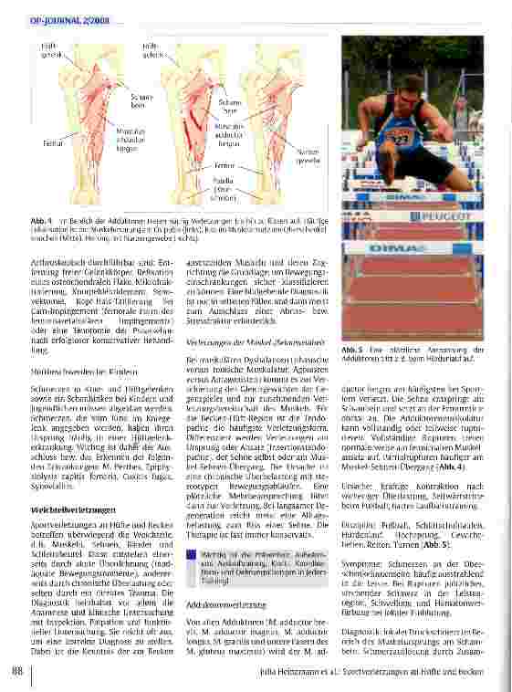 Vorschauseite 5: Sportverletzungen an Hüfte und Becken