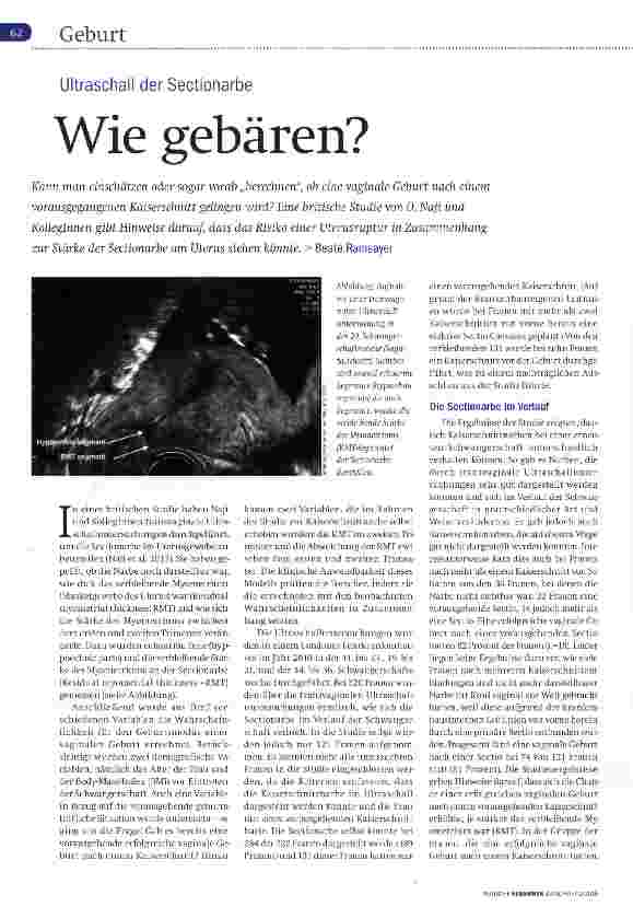 Vorschauseite 1: Ultraschall der Sectionarbe Wie gebären?