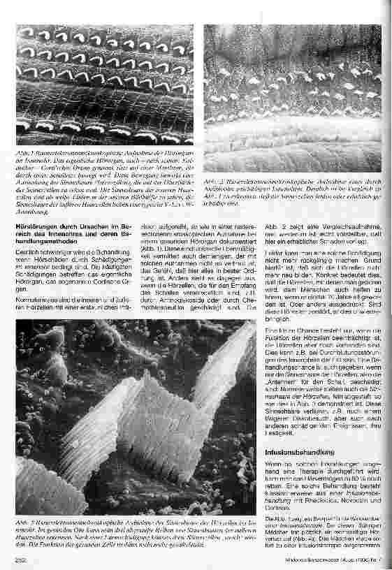 Vorschauseite 2: Das schwerhörige Kind Teil 2: Behandlung von Hörstörungen