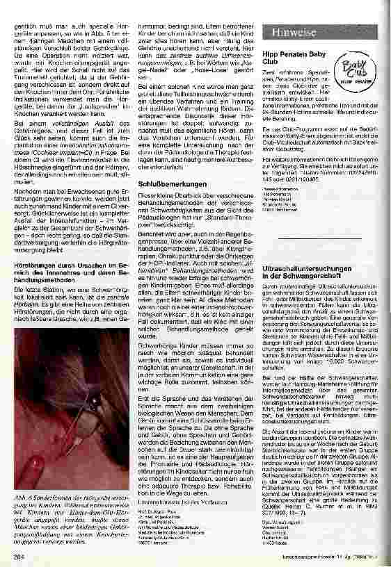 Vorschauseite 4: Das schwerhörige Kind Teil 2: Behandlung von Hörstörungen