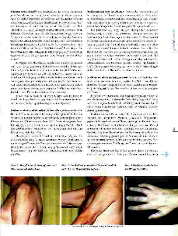 Vorschauseite 2: Physiotherapie bei amyotropher Lateralsklerose Wenn der Körper zum Gefängnis wird