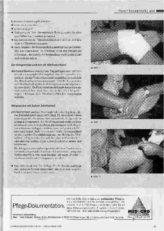 Vorschauseite 2: Die Kompressionstherapie