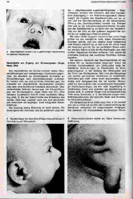 Vorschauseite 2: Lokale Anomalien der Haut bei Säuglingen und Kleinkindern