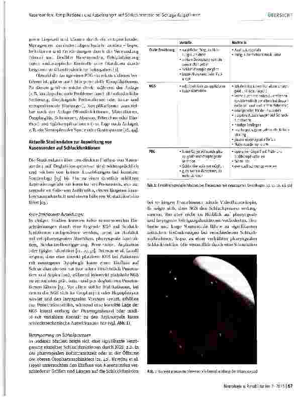 Vorschauseite 3: Nasensonden: Komplikationen und Auswirkungen auf Schluckprozesse bei Schlaganfallpatienten