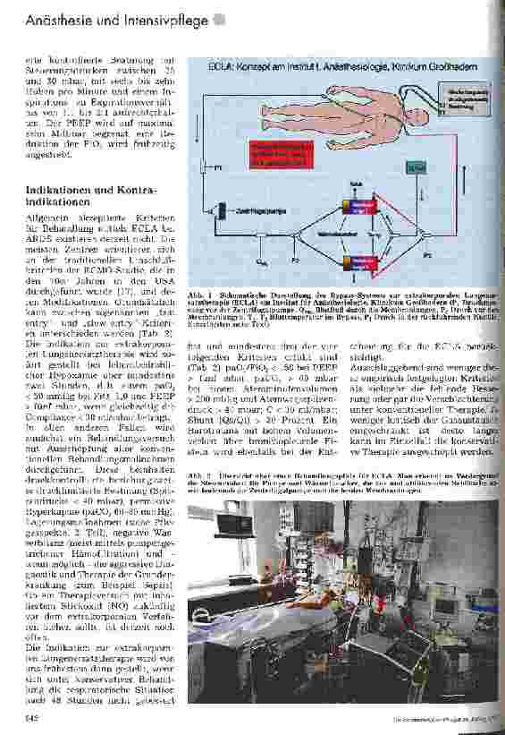 Vorschauseite 3: Extrakorporale Lungenersatztherapie 1. Teil