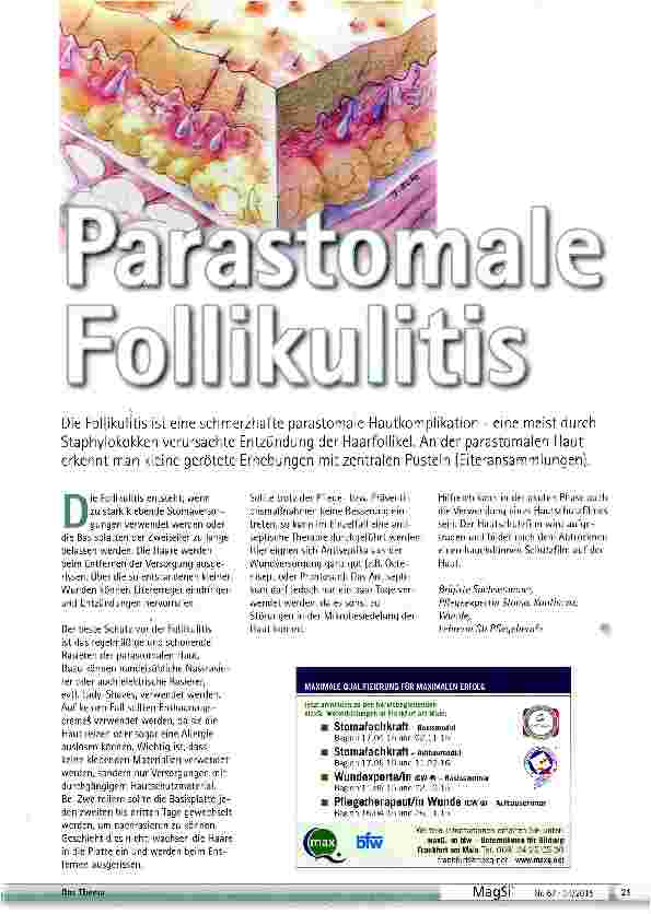 Vorschauseite 1: Parastomale Follikulitis