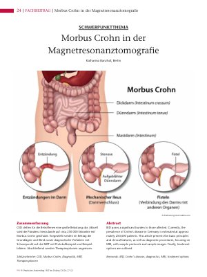 Vorschauseite 1: Morbus Crohn in der Magnetresonanztomografie