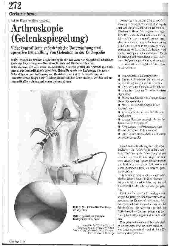 Vorschauseite 1: Arthoskopei (Gelenkspiegelung) / Videokontrollierte endoskopische Untersuchung und operative Behandlung v. Gelenken in der Orthopädie