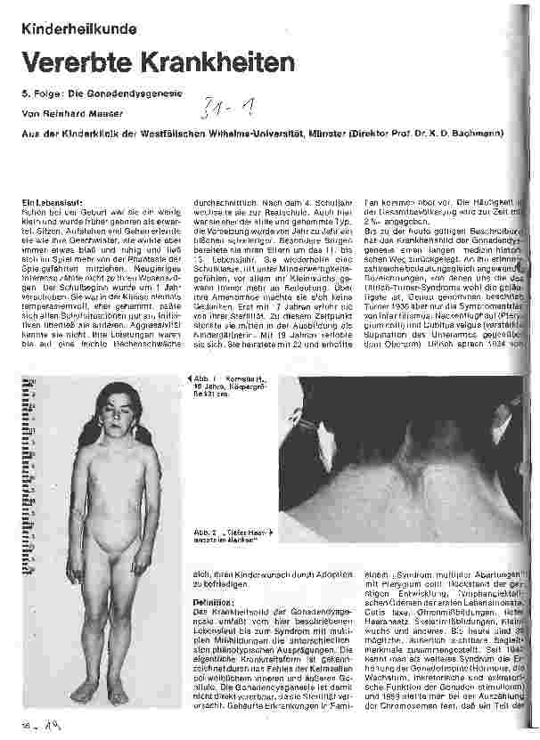 Vorschauseite 1: Kinderheilkunde Vererbte Krankheiten // 5. Folge: Gonadendysgenesie