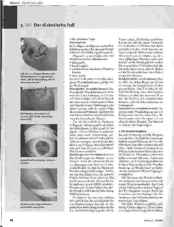 Vorschauseite 3: Wundmanagement des diabetischen Fußes