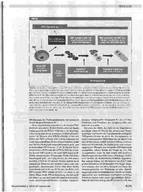 Vorschauseite 2: Pathogenese, Klinik, Diagnostik und Therapie transplantationsassoziierter lymphoproliferativer Erkrankungen