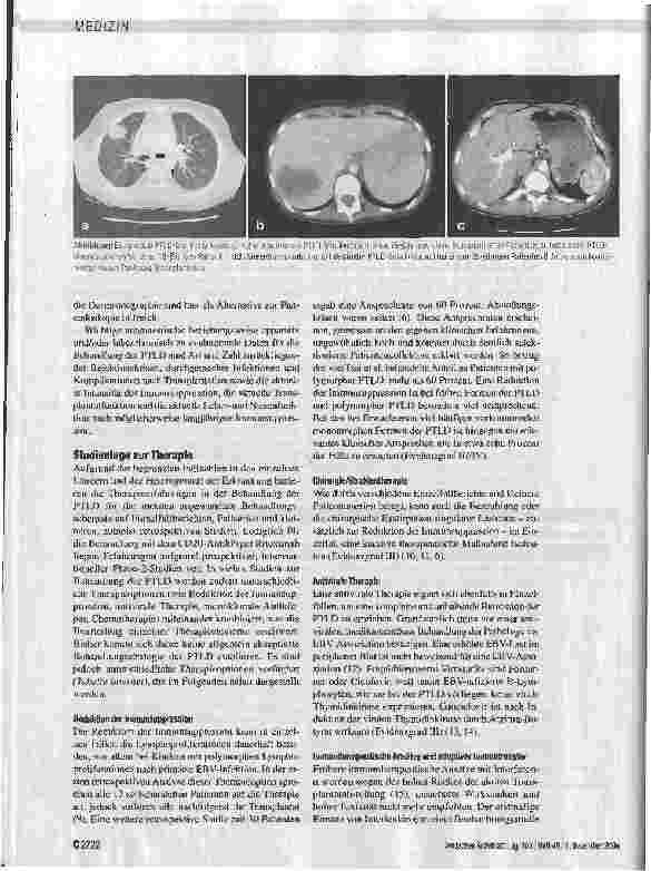 Vorschauseite 5: Pathogenese, Klinik, Diagnostik und Therapie transplantationsassoziierter lymphoproliferativer Erkrankungen