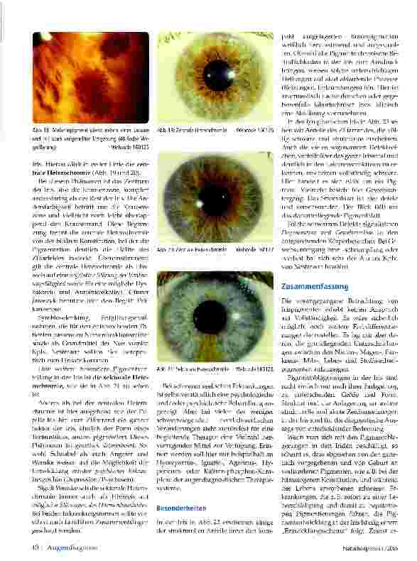 Vorschauseite 5: Pigmente in der Augendiagnose