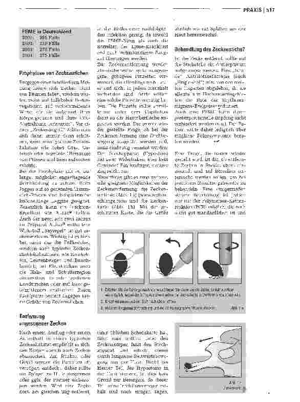 Vorschauseite 2: Zeckenstich, Lyme-Krankheitund Frühsommer-Meningoenzephalitis