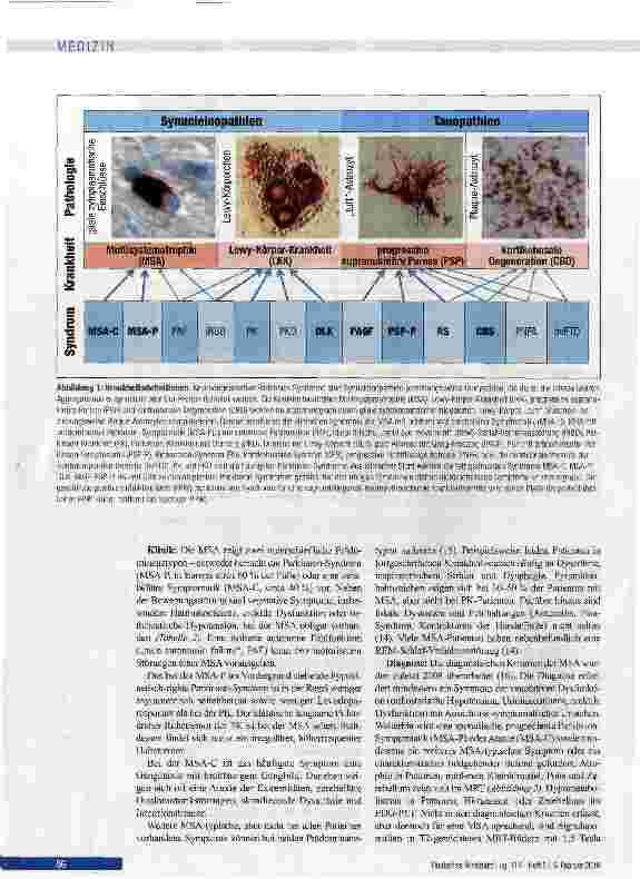 Vorschauseite 6: Differenzialdiagnose und Therapie der atypischen Parkinson-Syndrome