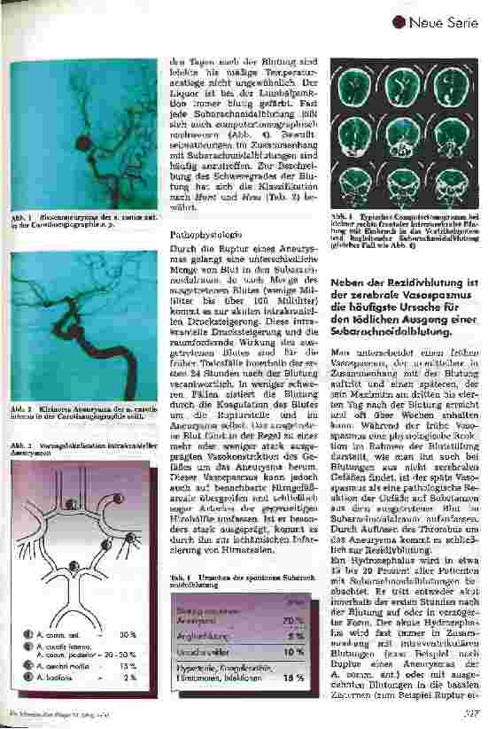 Vorschauseite 2: Postoperative Pflege in der Neurochirurgie Teil 1: Subarachnoidalblutung/Hirnarterienaneurysma