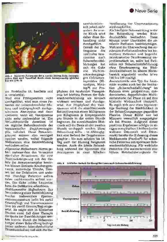 Vorschauseite 4: Postoperative Pflege in der Neurochirurgie Teil 1: Subarachnoidalblutung/Hirnarterienaneurysma
