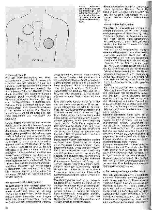 Vorschauseite 3: Das Herz 21. Folge (Schluß) Behandlung von Komplikationen nach Herzoperationen