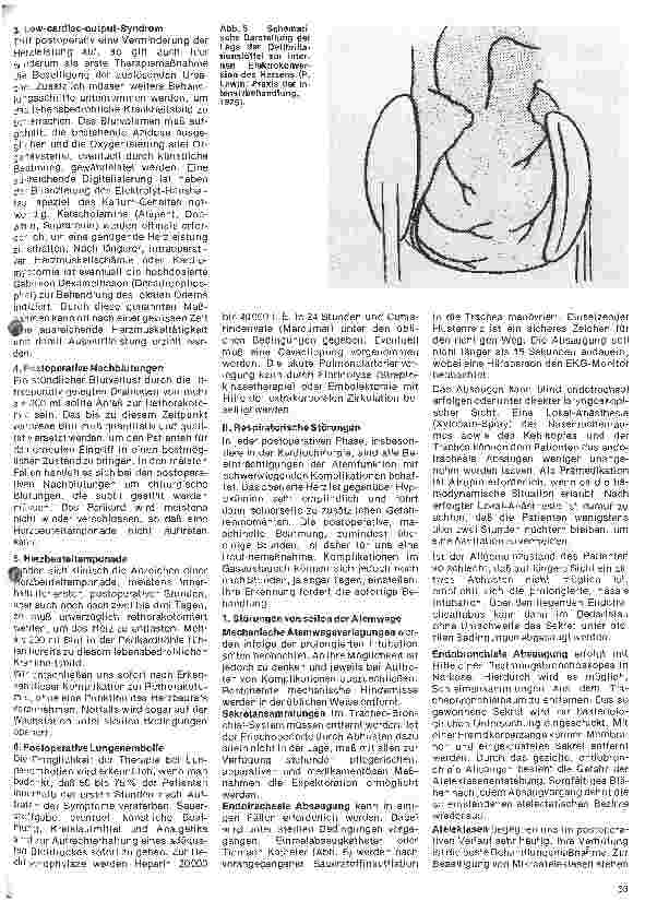 Vorschauseite 4: Das Herz 21. Folge (Schluß) Behandlung von Komplikationen nach Herzoperationen
