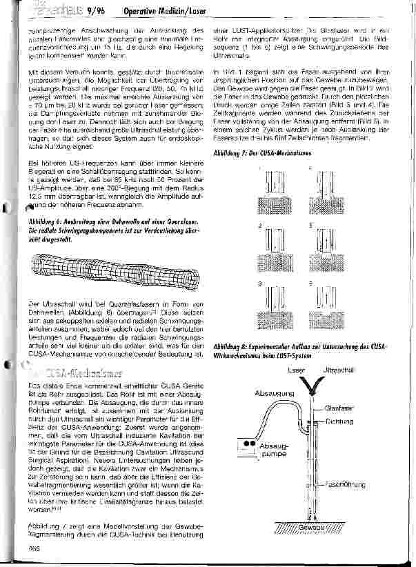 Vorschauseite 4: Ein neues Konzept zur Kombinationsanwendung von Laser und Ultraschall für die minimal invasive Medizin