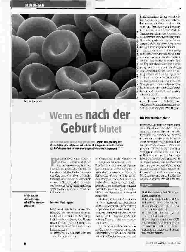 Vorschauseite 1: Wenn es nach der Geburt blutet