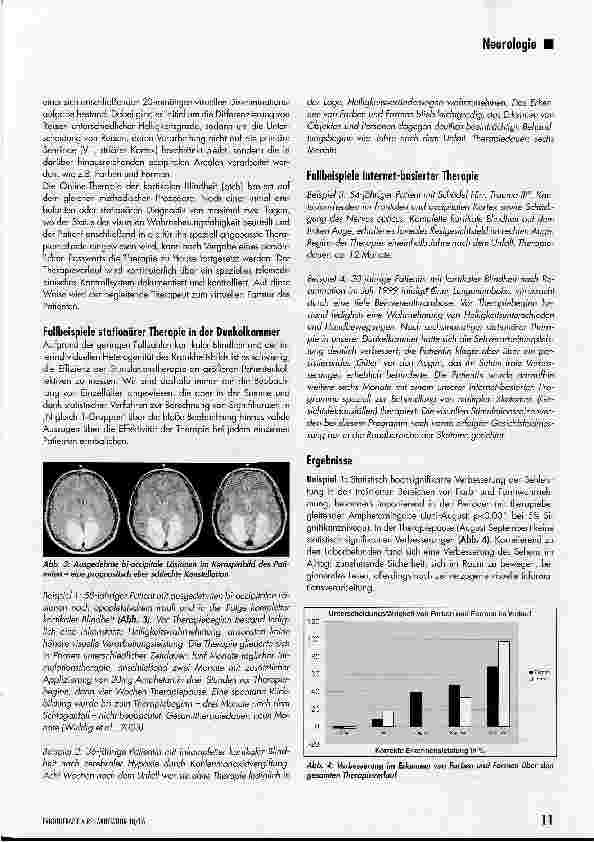 Vorschauseite 2: Therapiemöglichkeiten kortikaler Sehstörungen