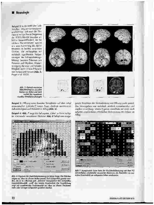 Vorschauseite 3: Therapiemöglichkeiten kortikaler Sehstörungen