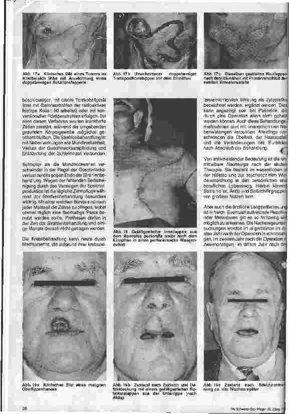 Vorschauseite 6: Kieferchirurgie und Plastische Gesichtschirurgie 6.Folge