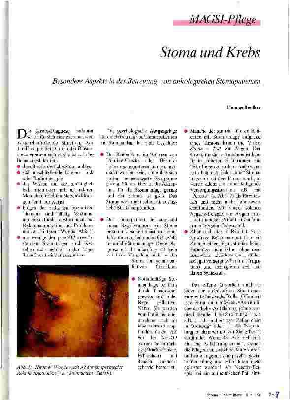 Vorschauseite 1: Stoma und Krebs Besondere Aspekte in der Betreuung von onkologischen Stomapatienten