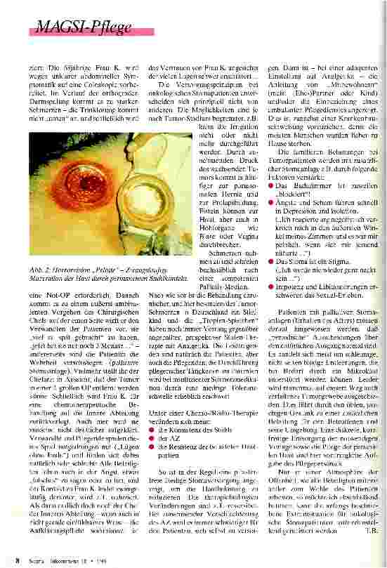 Vorschauseite 2: Stoma und Krebs Besondere Aspekte in der Betreuung von onkologischen Stomapatienten